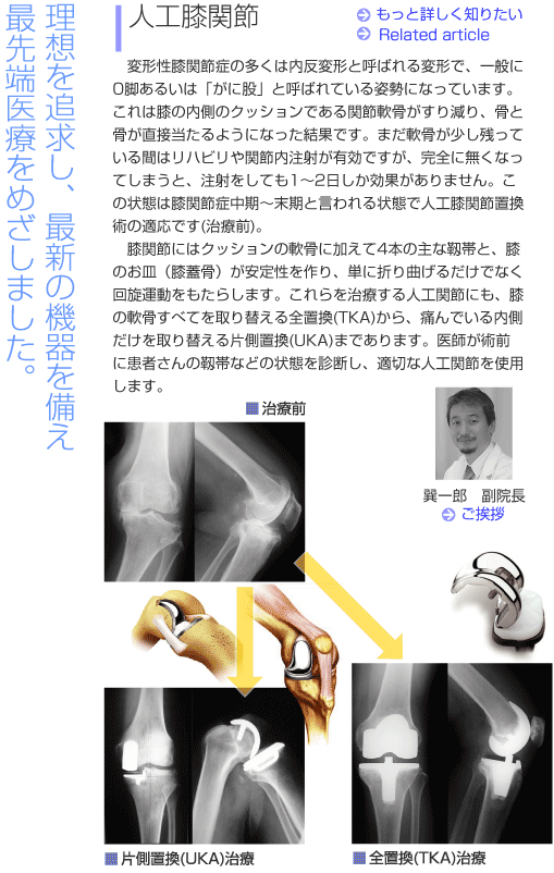 人工関節-湘南鎌倉人工関節センターImage03-2